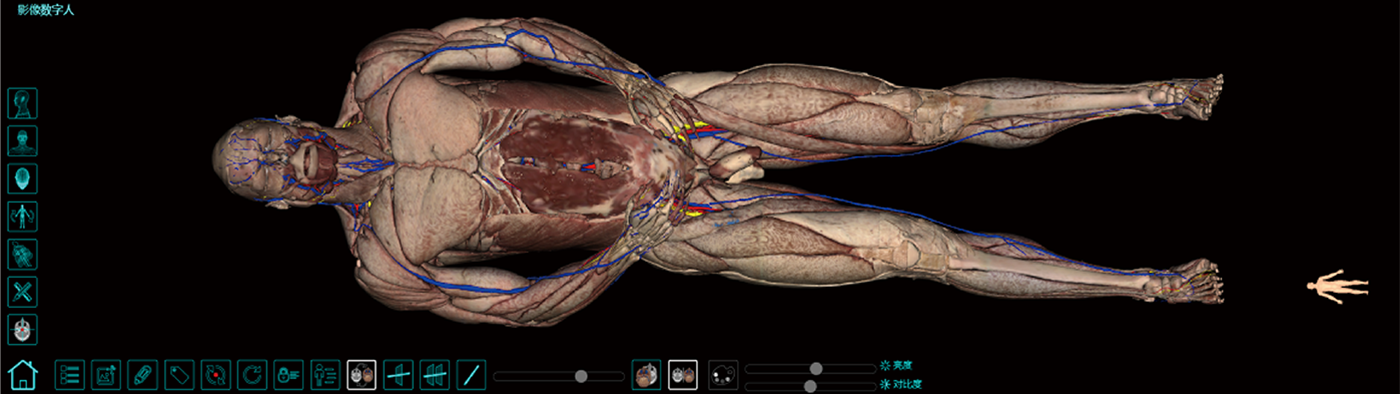 3.2-影像解剖 (2).png