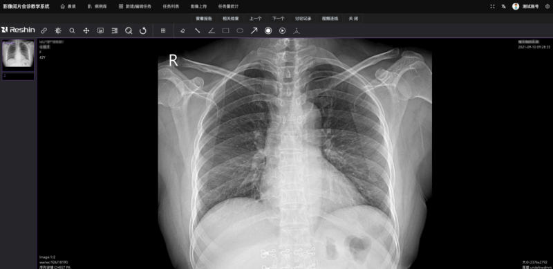 6548a141cf621b444ec9133cf853b61b_640_wx_fmt=png&wxfrom=5&wx_lazy=1&wx_co=1.png