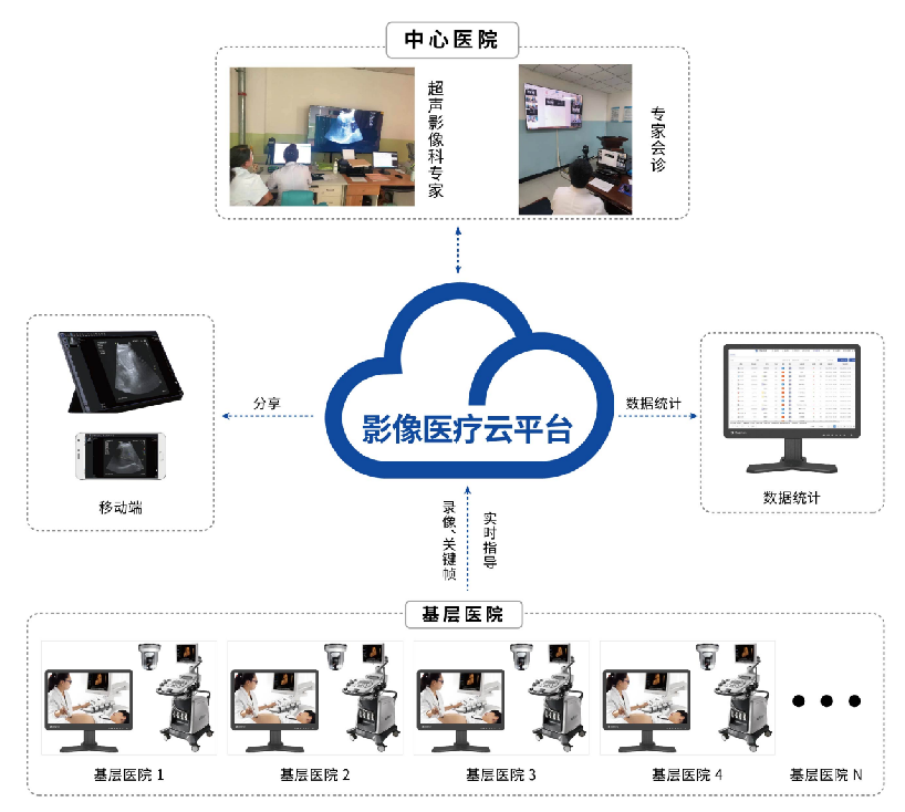 睿显远程超声系统