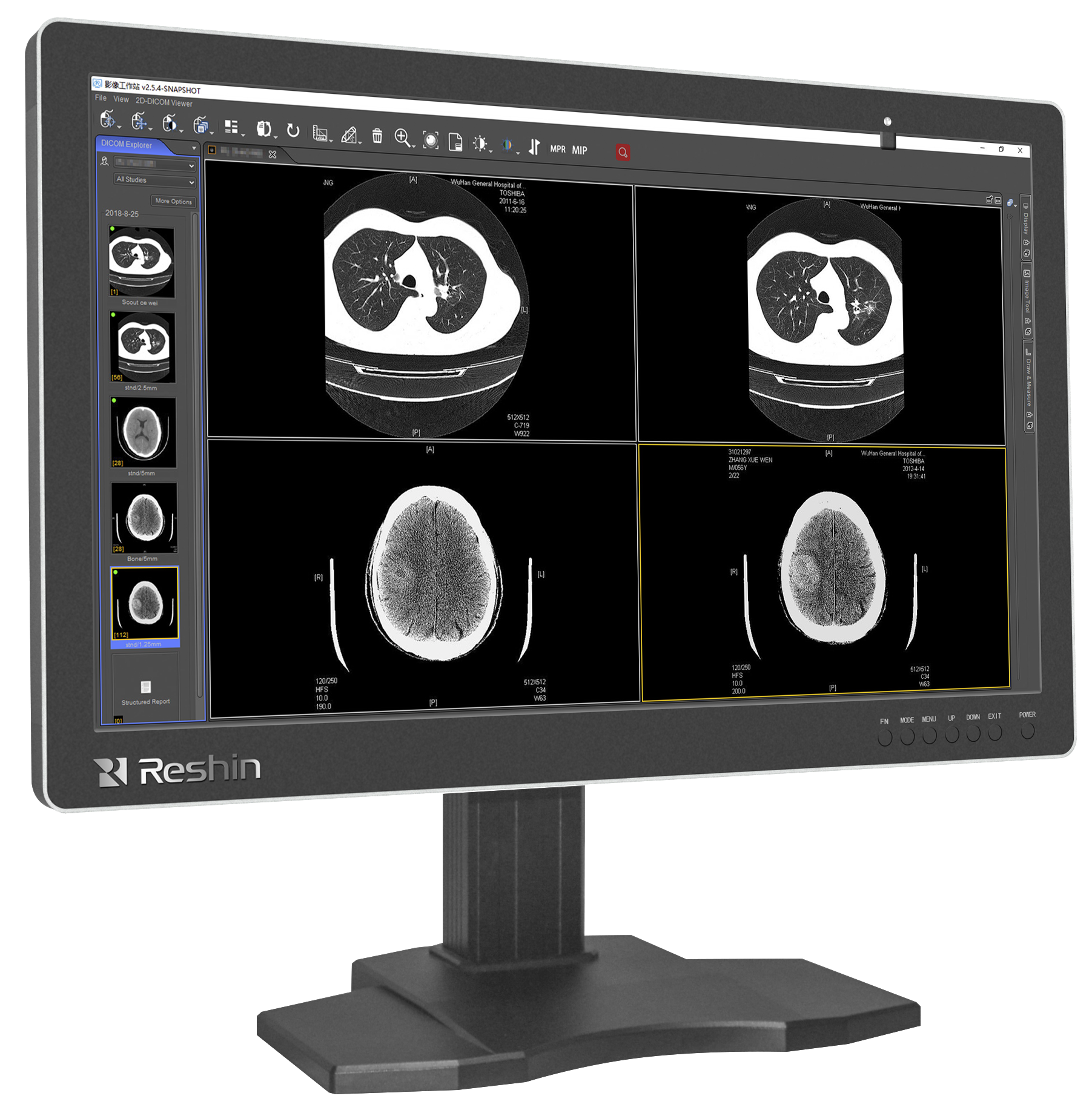 医用影像显示器