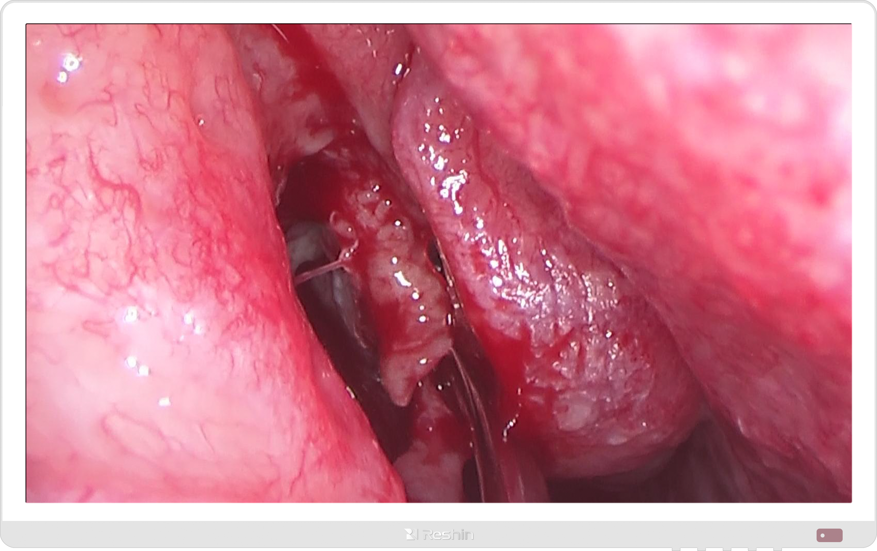 外科手术显示器