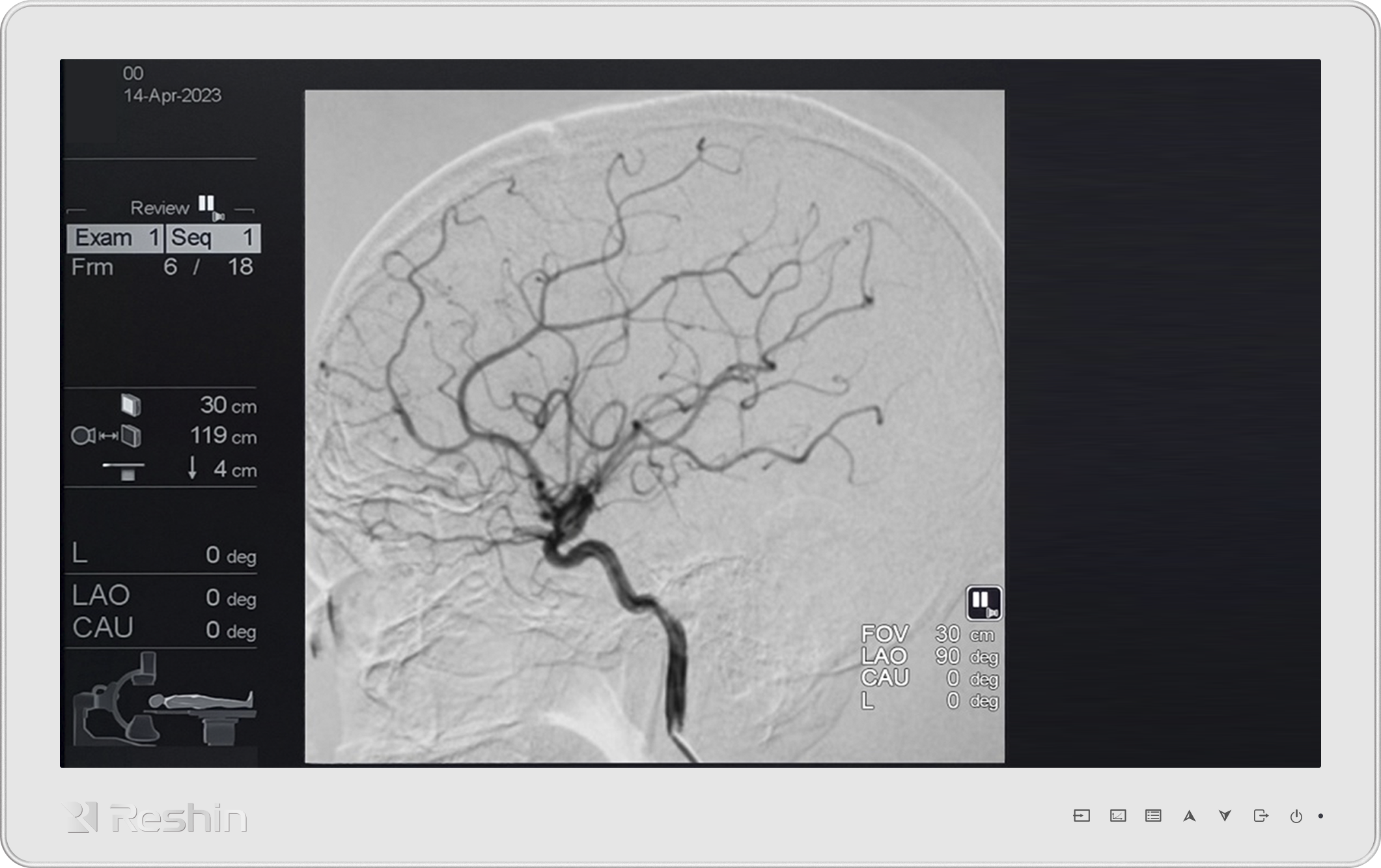 外科手术显示器