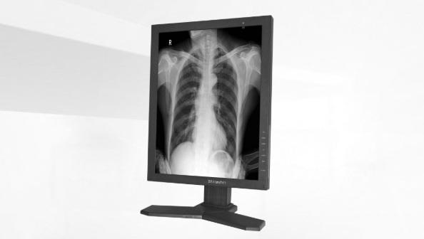 医用显示器