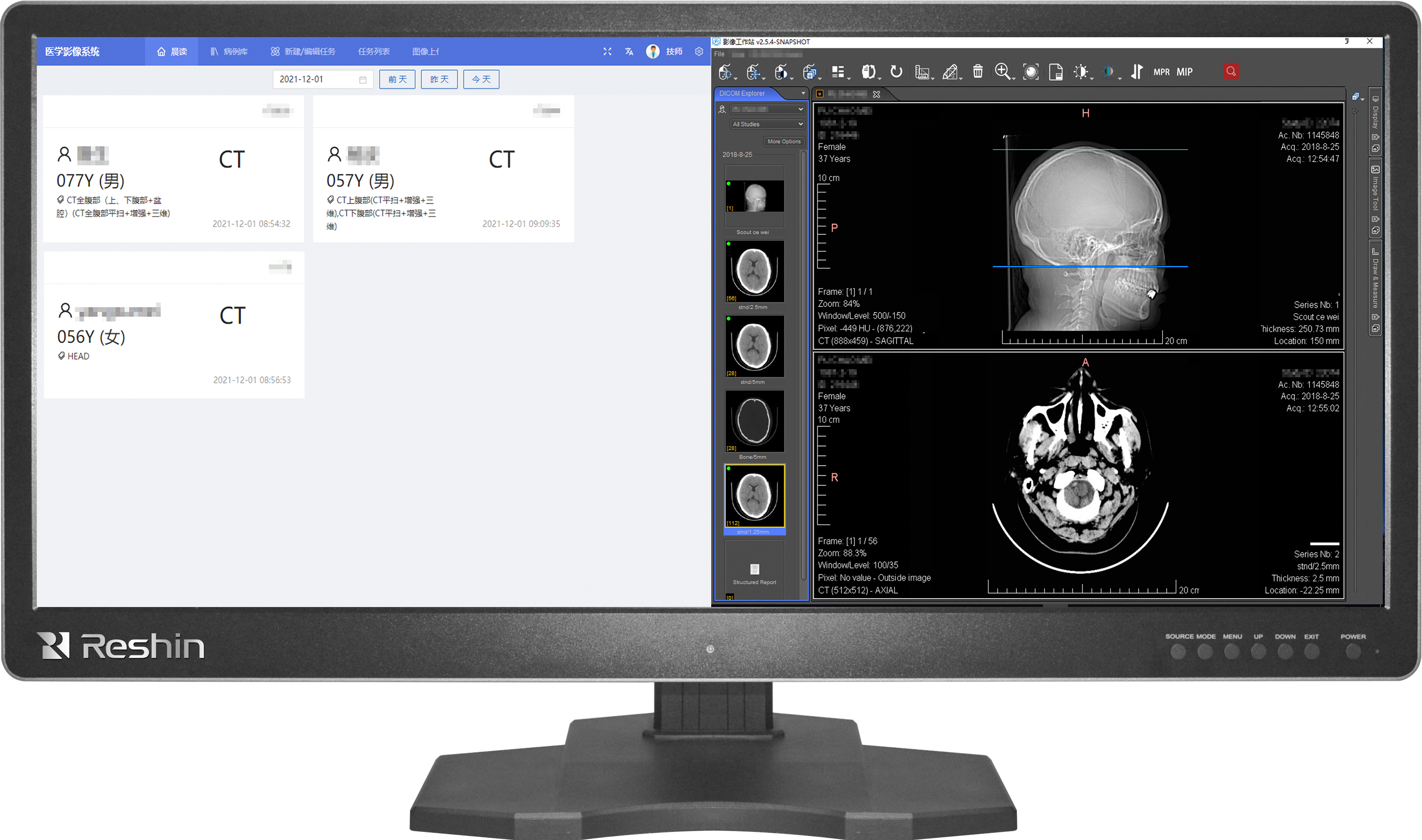 内外网隔离医疗一体机