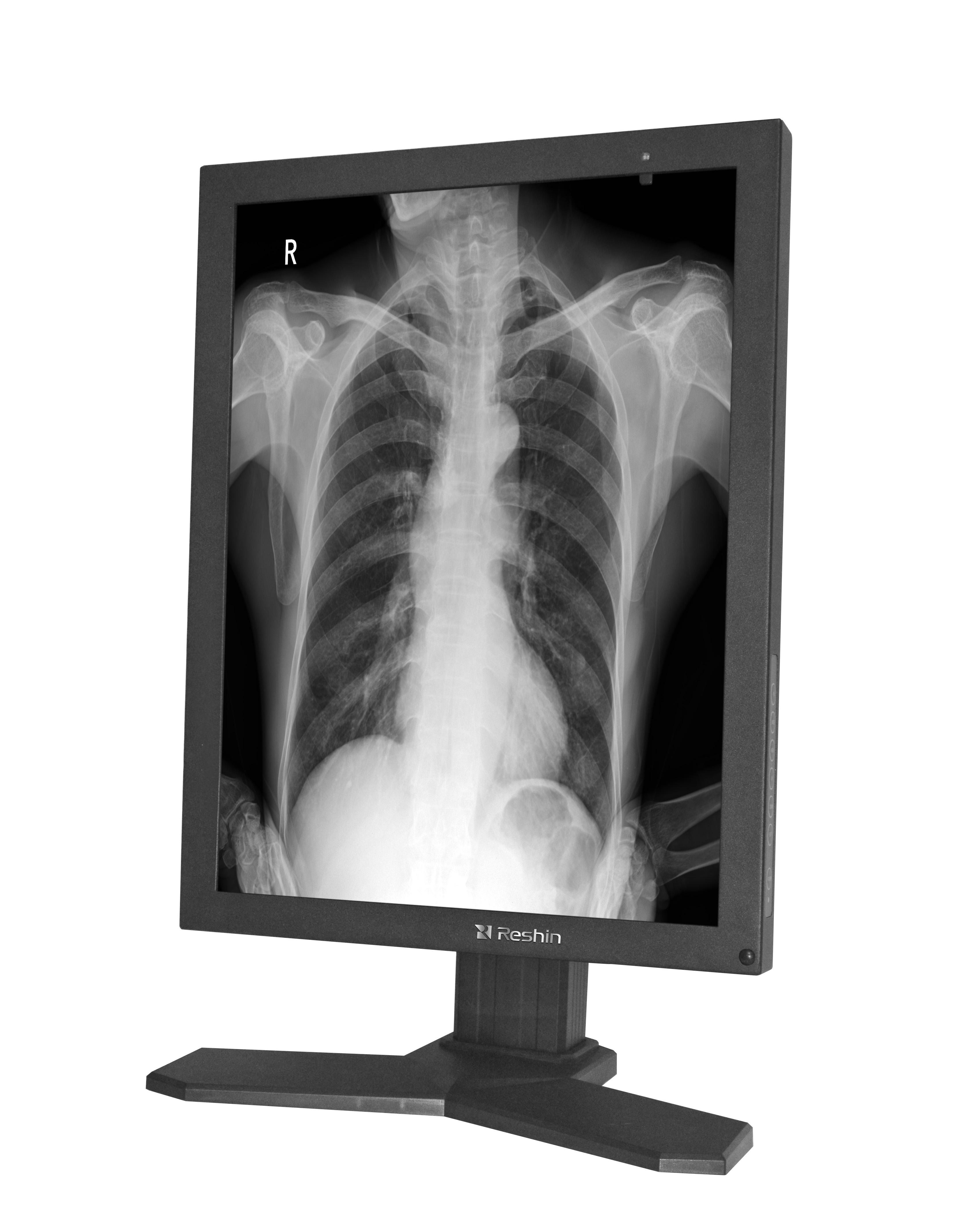 医用诊断显示器