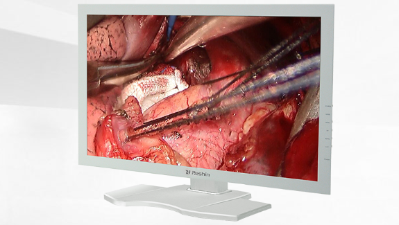 手术显示器