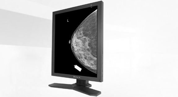 医用影像显示器