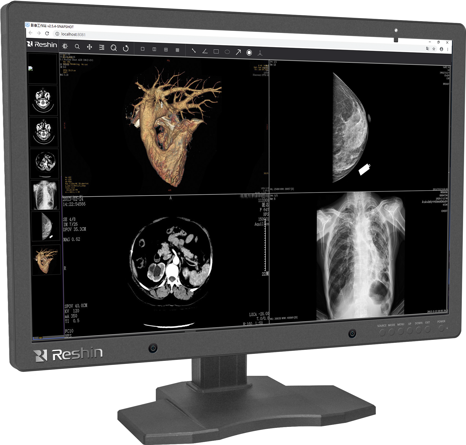 医用影像显示器
