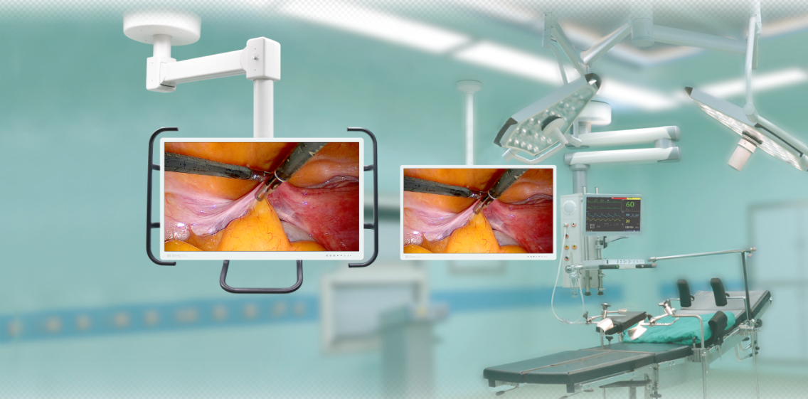 内窥手术显示器