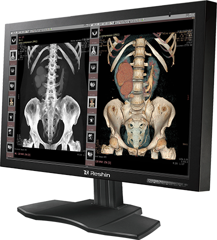 医用显示器