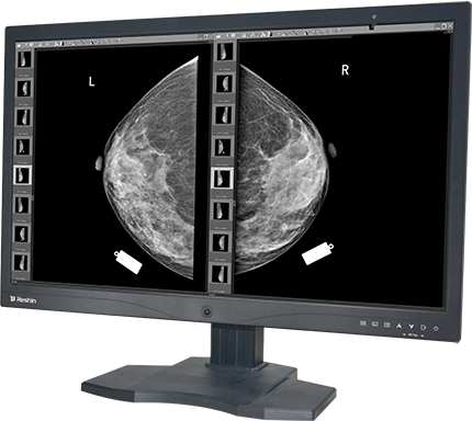 医用显示器