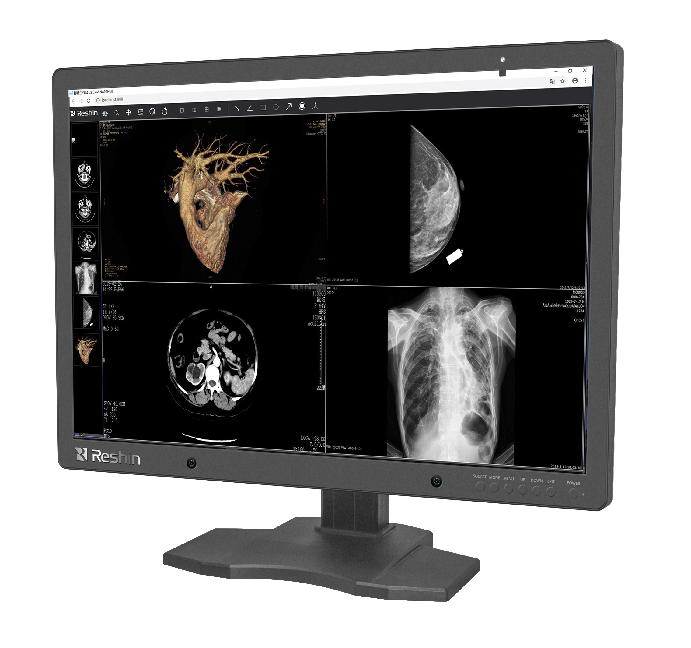 医用专业显示器