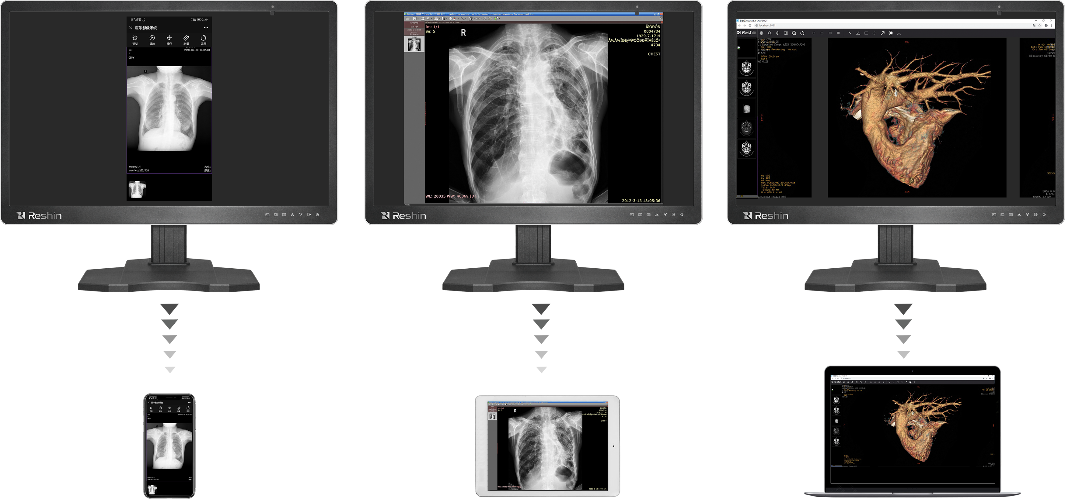 医用诊断显示器