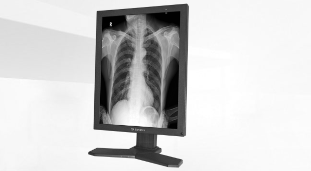 医疗显示器