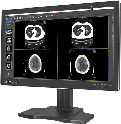 医用影像显示器