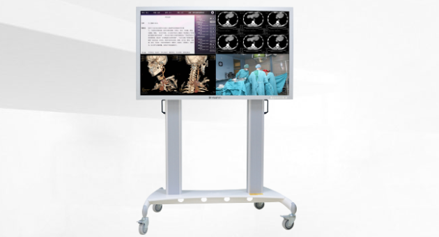 外科手术显示器