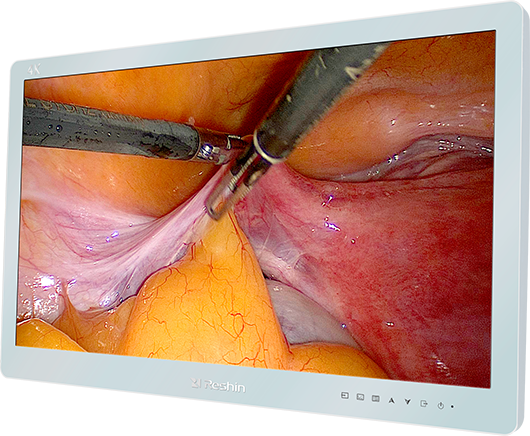 �ڿ���ʾ��