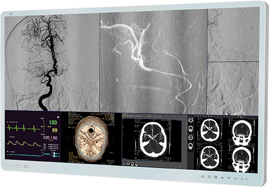 �ڿ���ʾ��