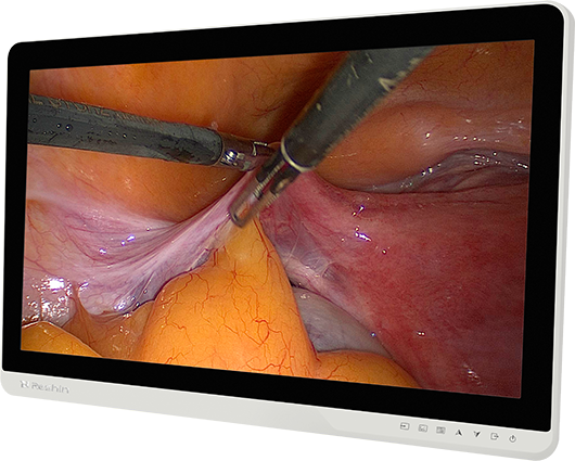 手术显示器