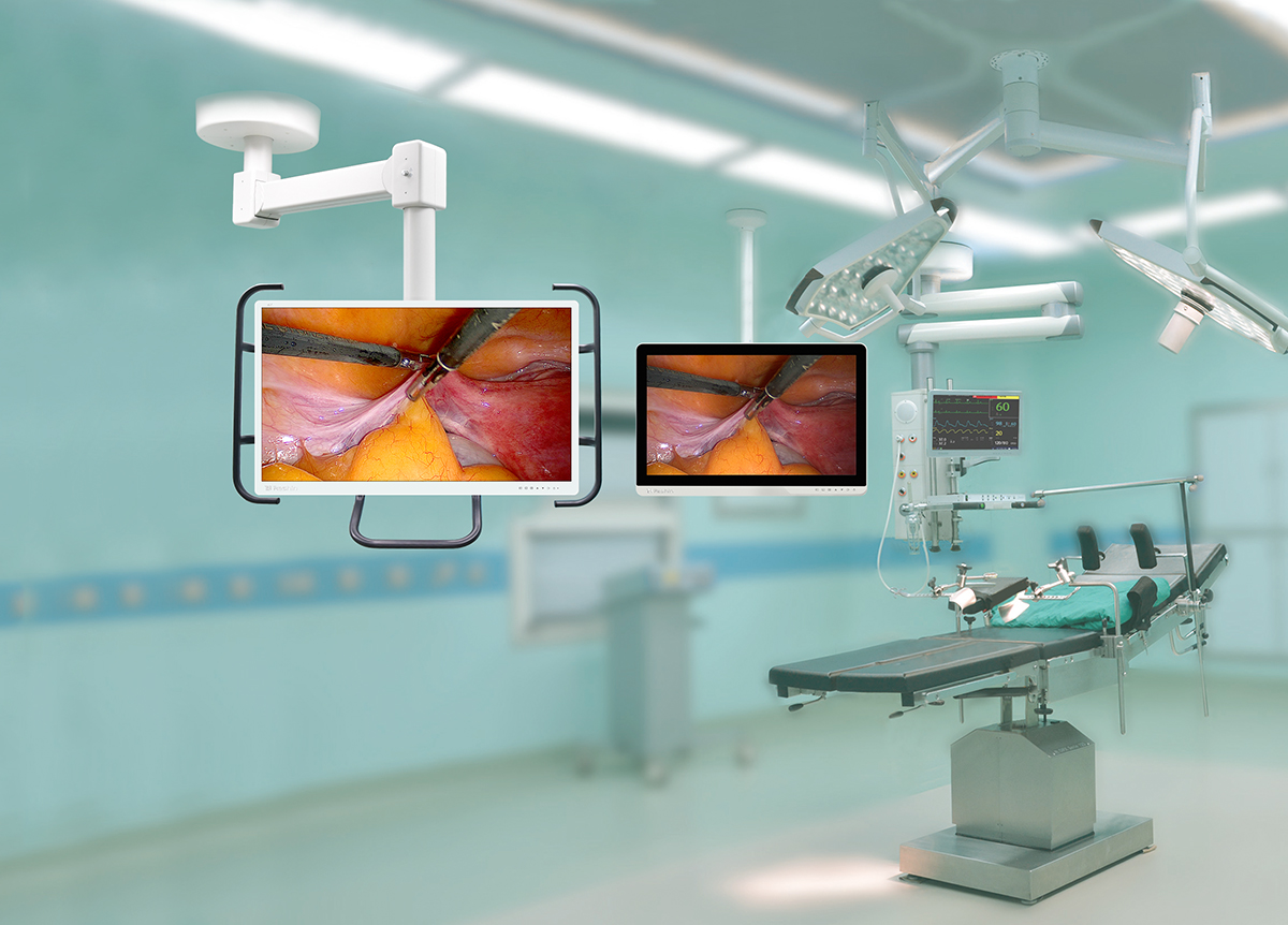 手术显示器