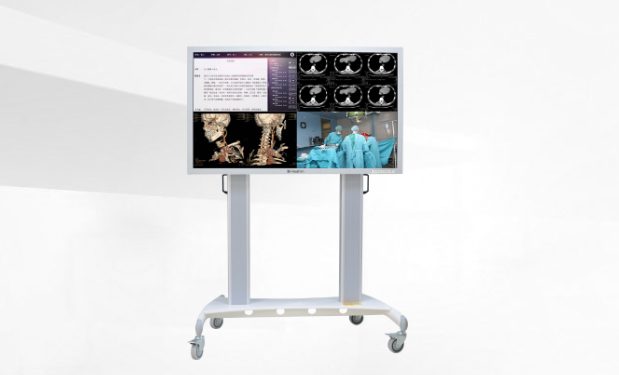 会诊显示屏