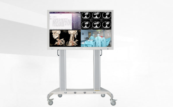 会诊显示屏
