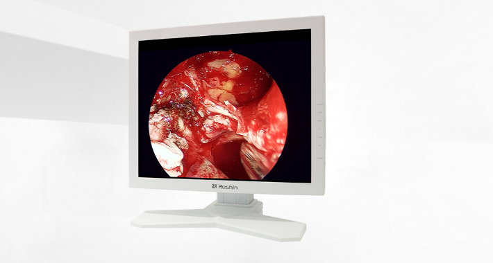 手术显示器