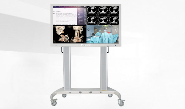 医用大屏显示器