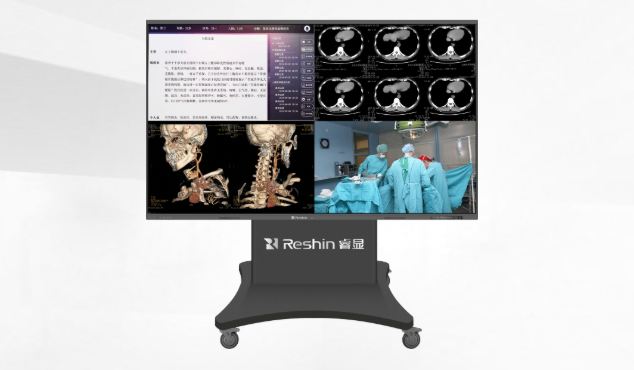 会诊显示器