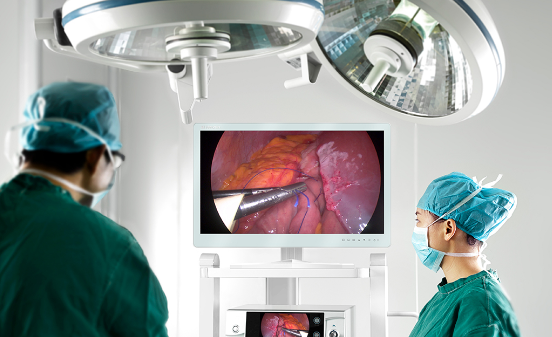 手术显示器