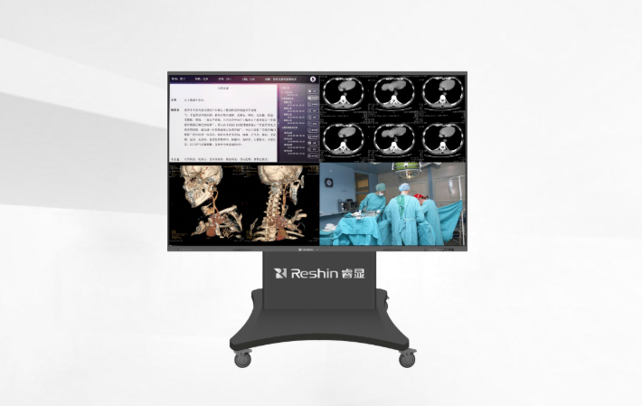 会诊显示器