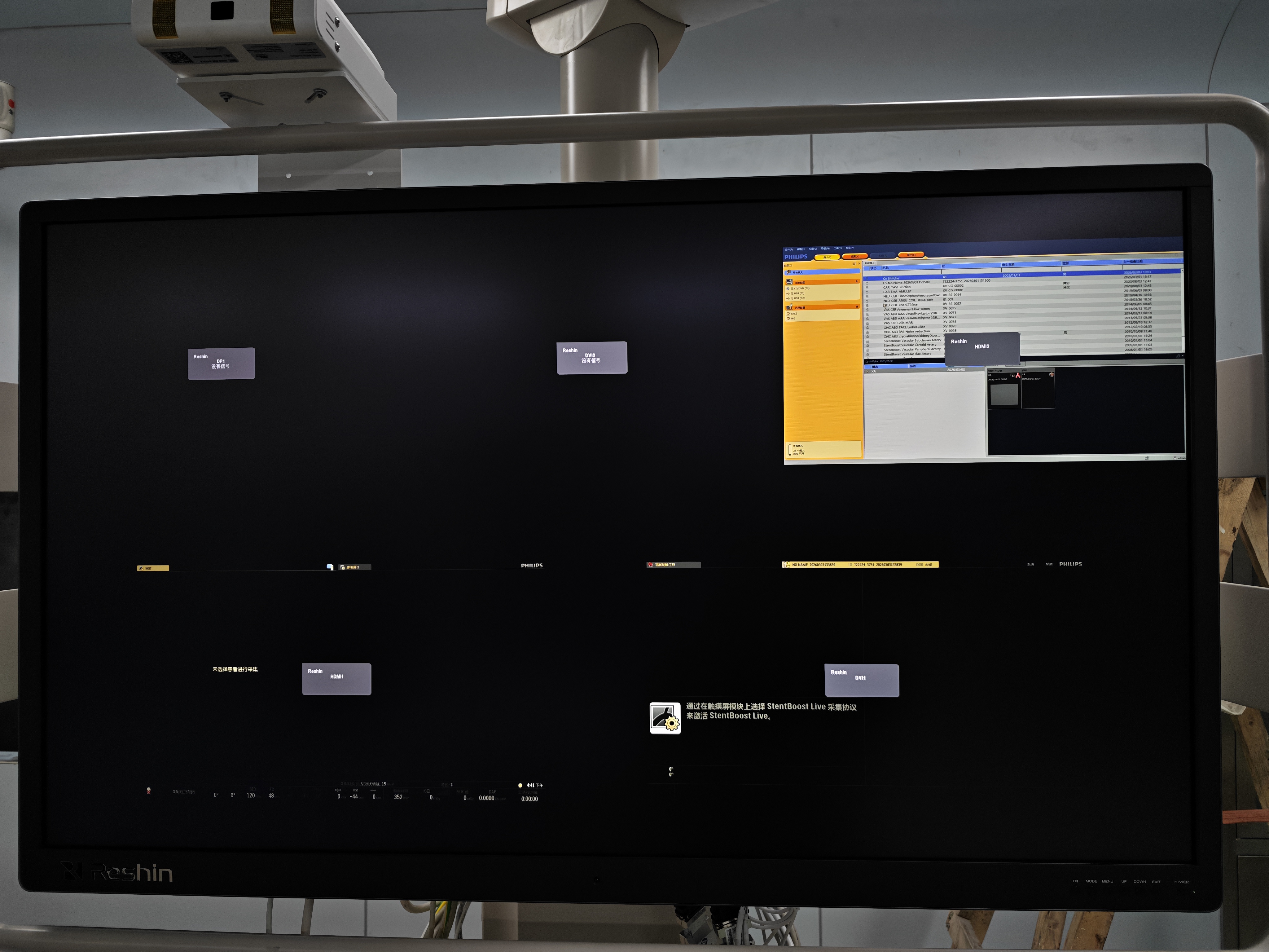 医用大屏显示器