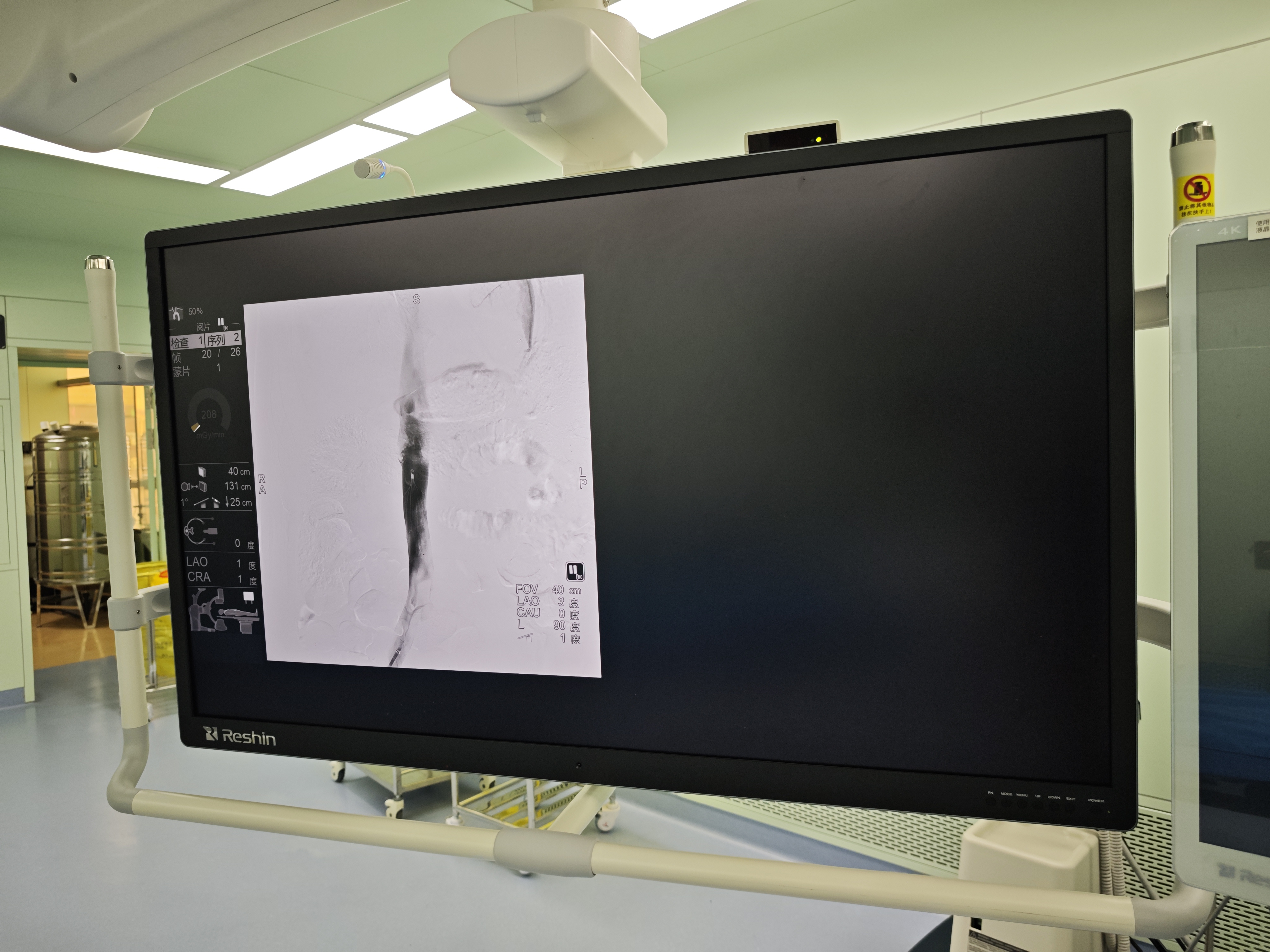 医用大屏显示器