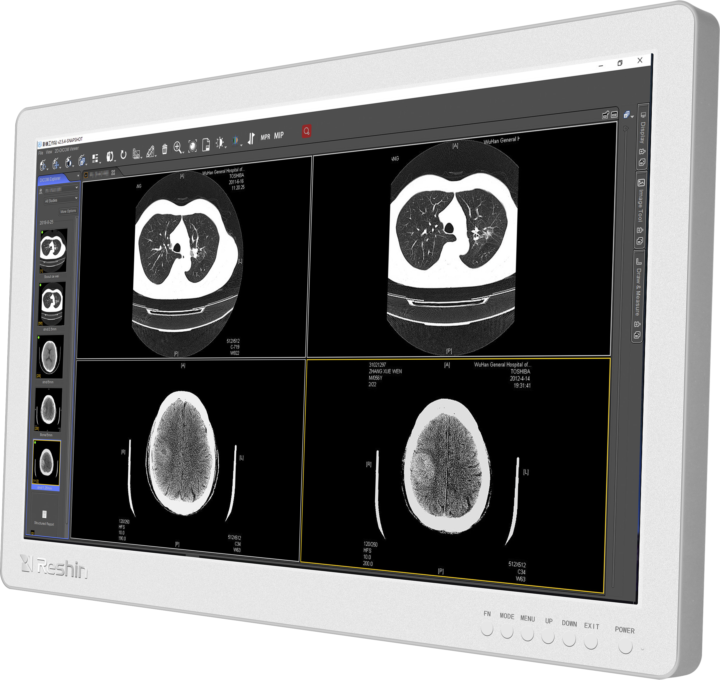 医用专业显示器