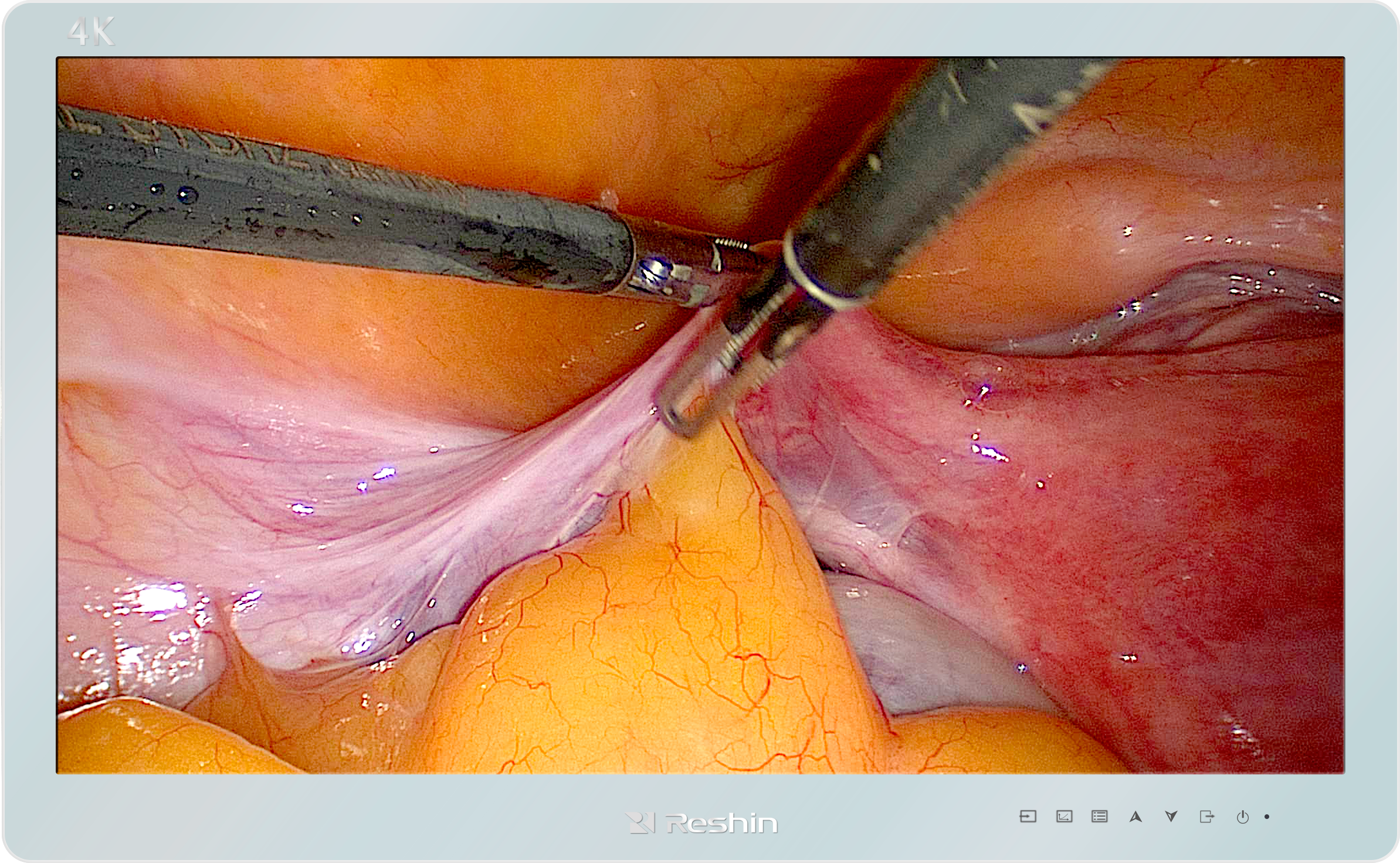 内窥手术显示器