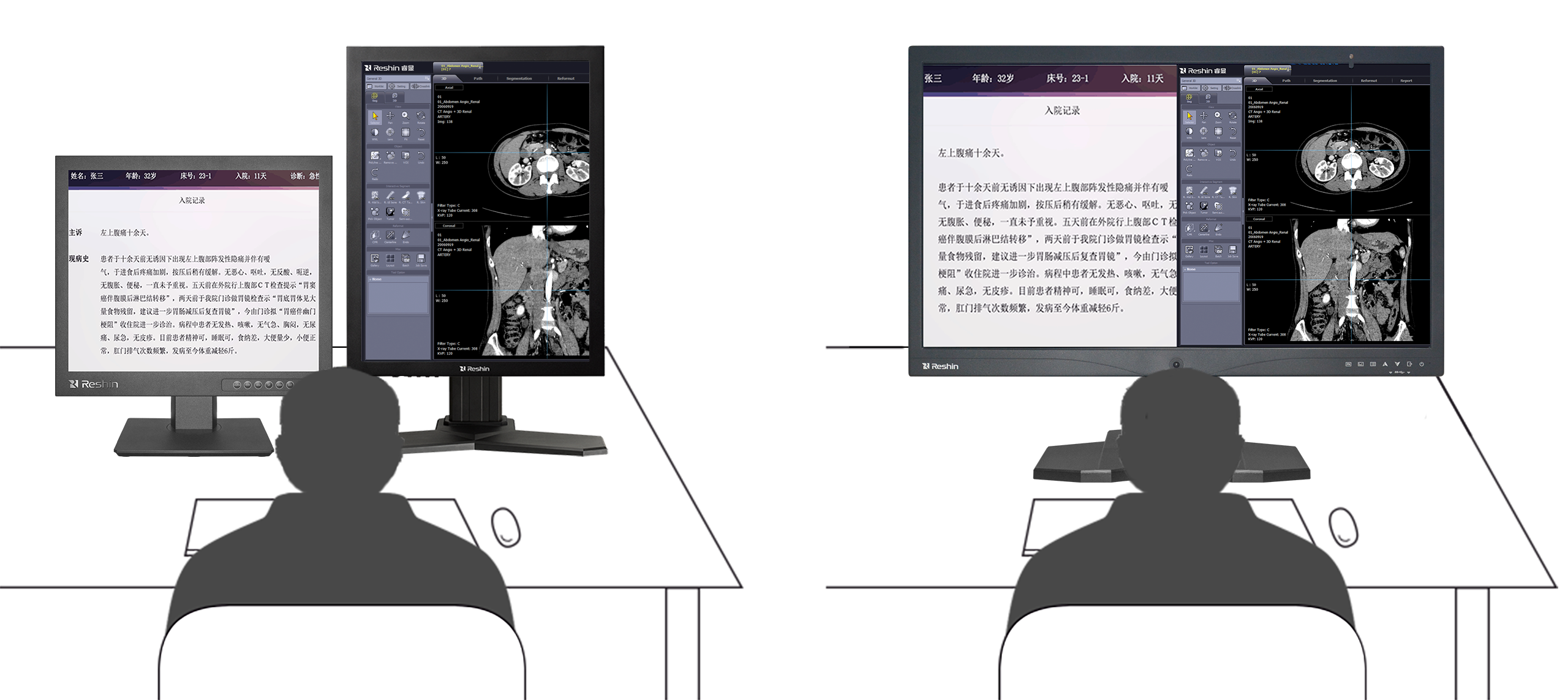 医疗显示屏