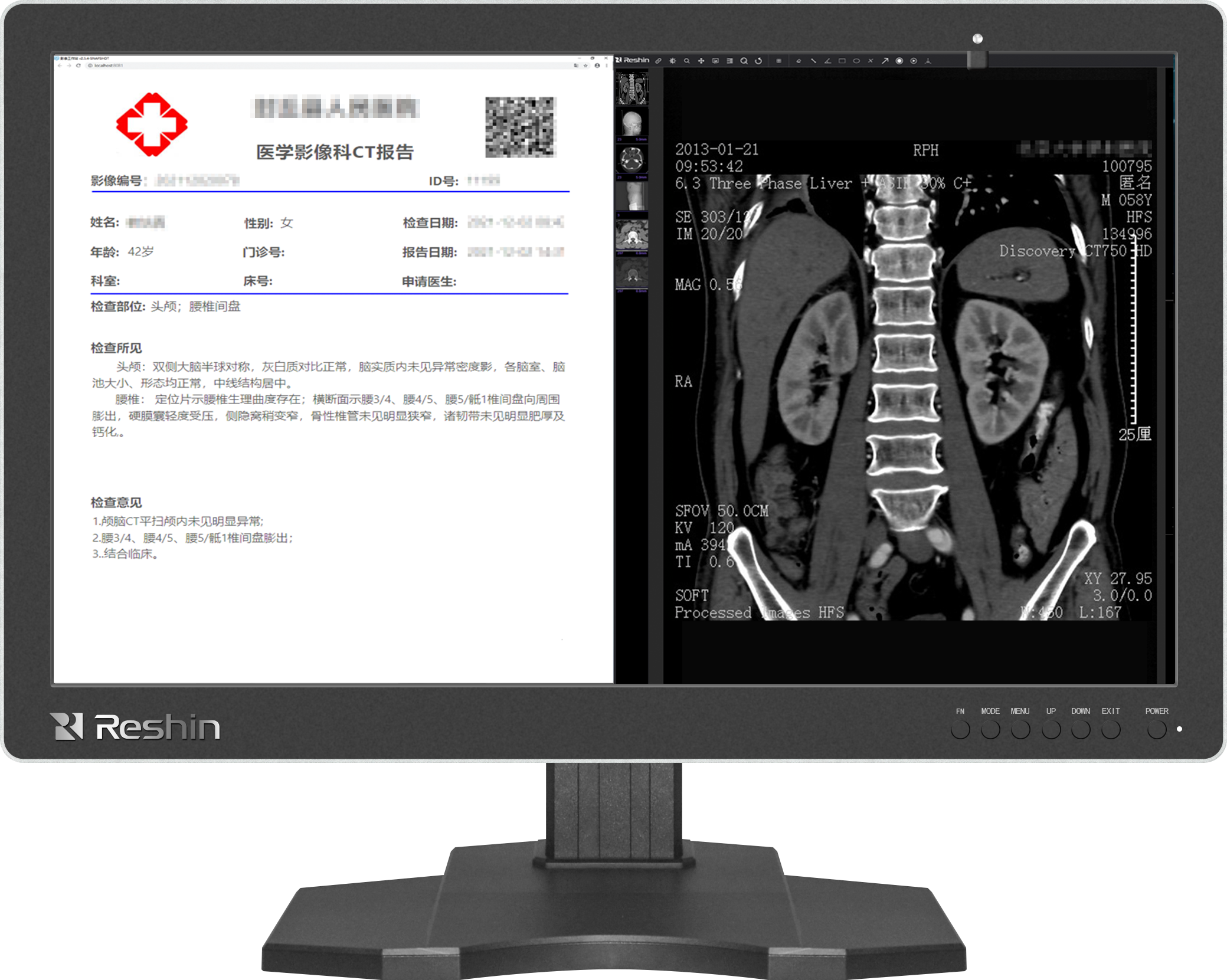 医用显示设备