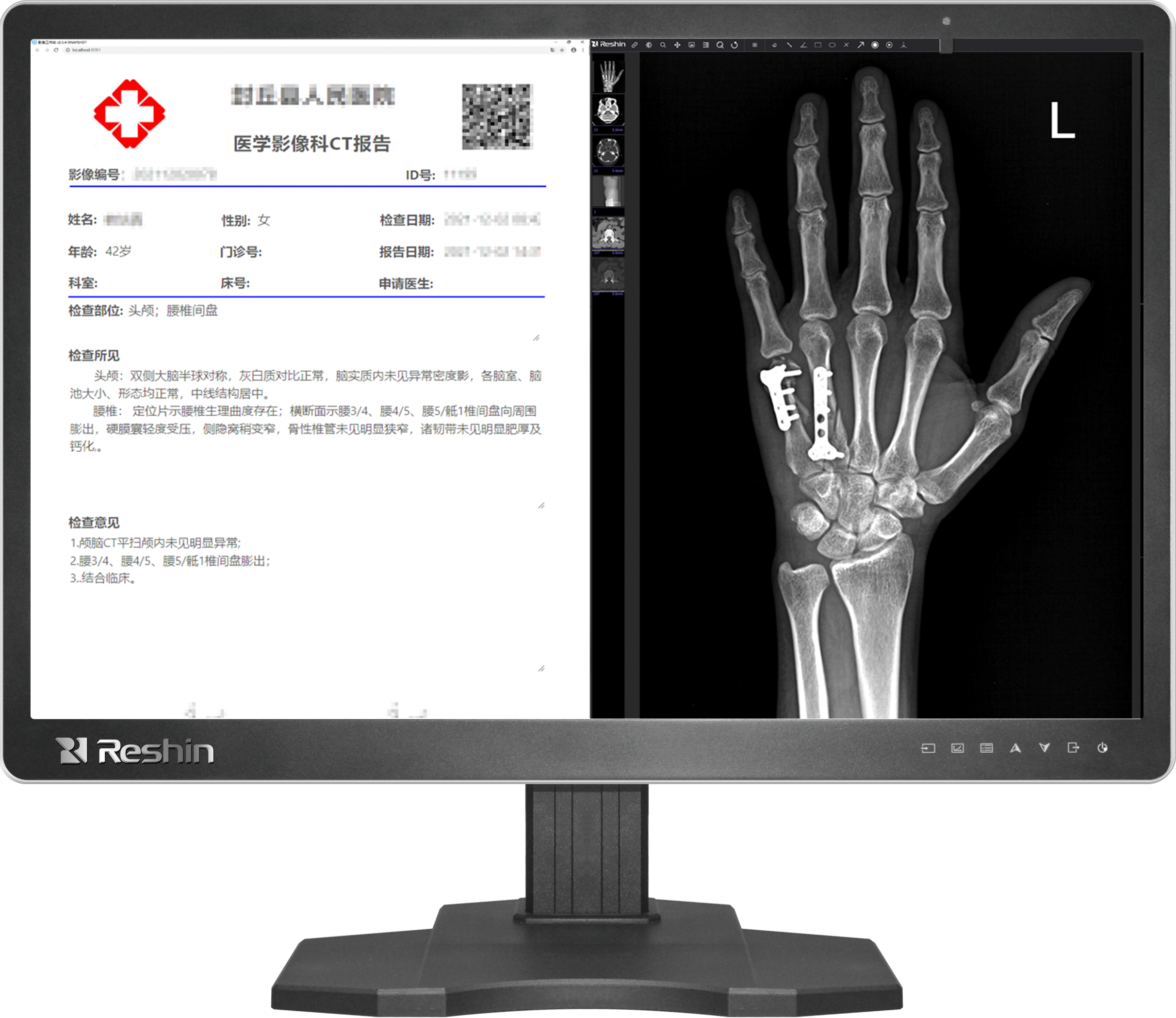 医疗显示屏