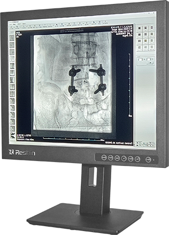 MD17G
