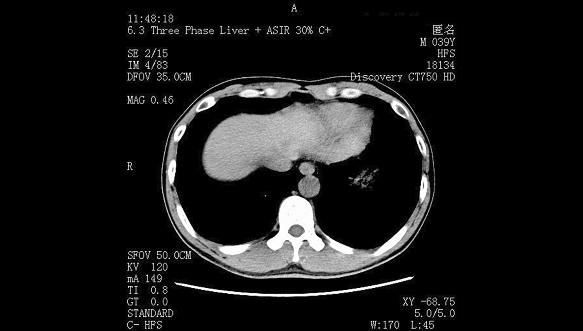 CT/MRI